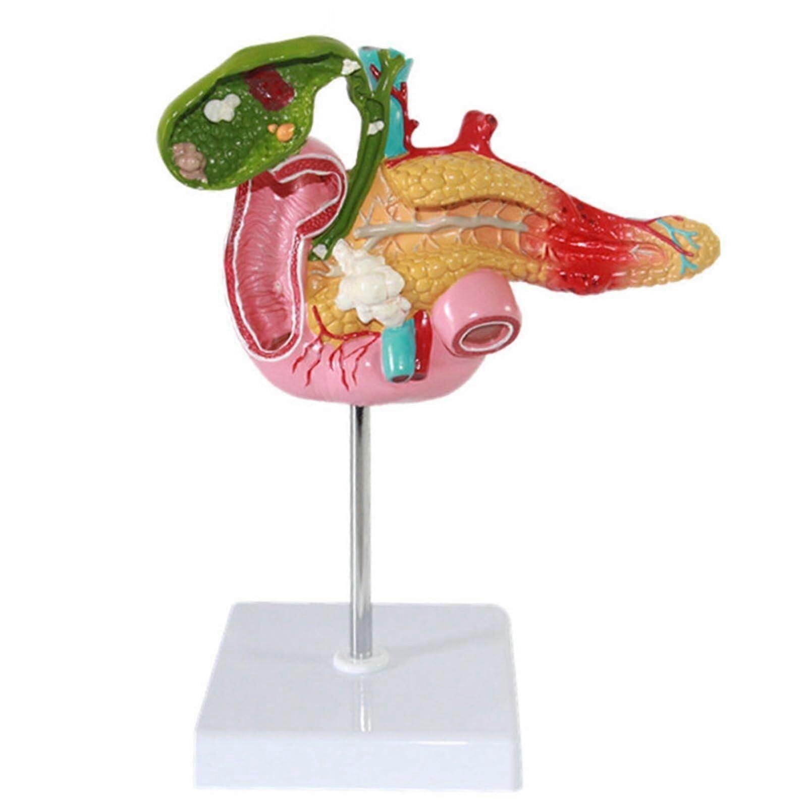 LifeSize Anatomical Teaching Model with Human Digestive System, Pancreas Duodenum Pathology Aid