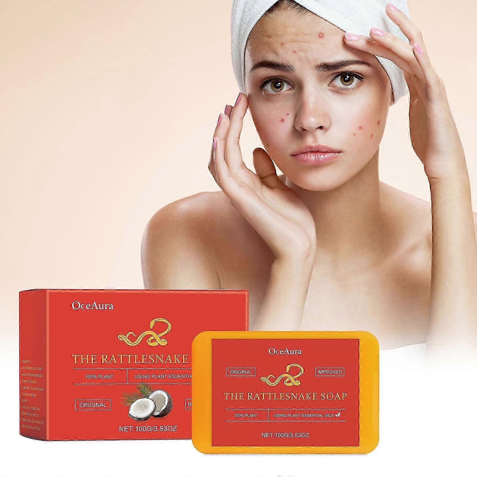 Skin care anti-acne soap, acne closing plant essential oil soap, oil control hand soap, foam cleansing soap