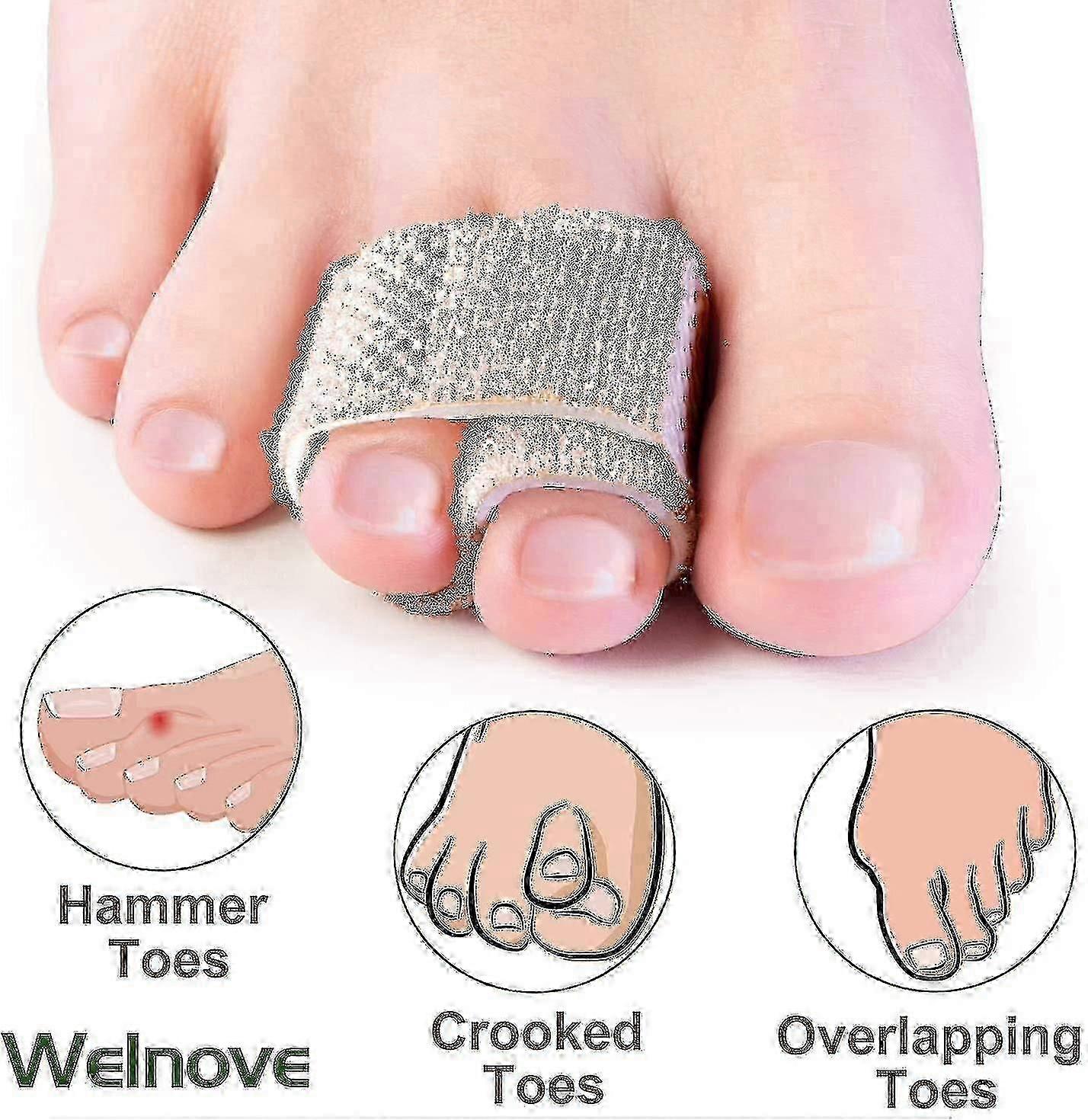 6-pcs Of Hammer Toe Straighteners For Straightening Hammer Toes, Broken Toes, Crooked Toes And Overlapping Toes f54