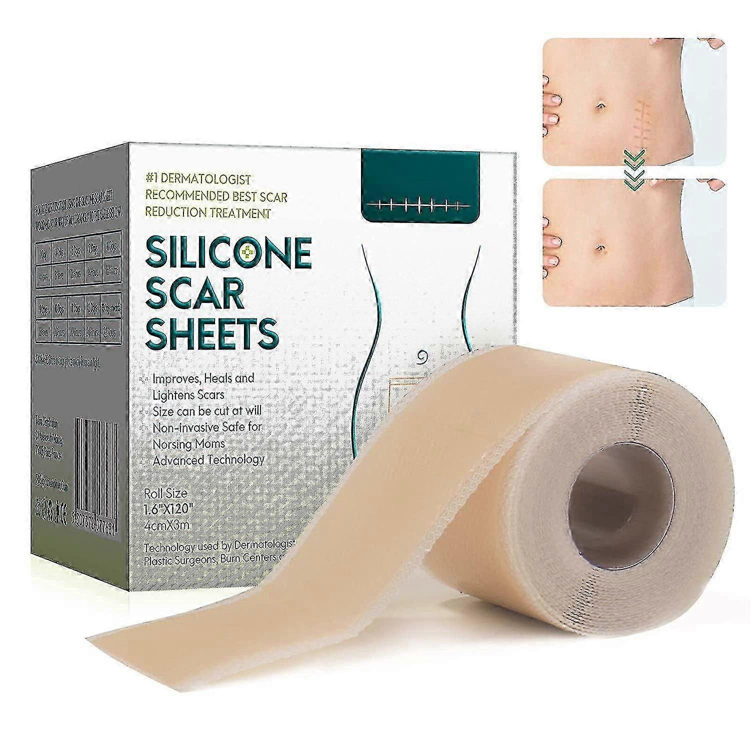Silikon ärrplåster, silikonplåster för ärr, silikon ärrfilmer, silikon ärrplattor för C-sektion kirurgiska ärr