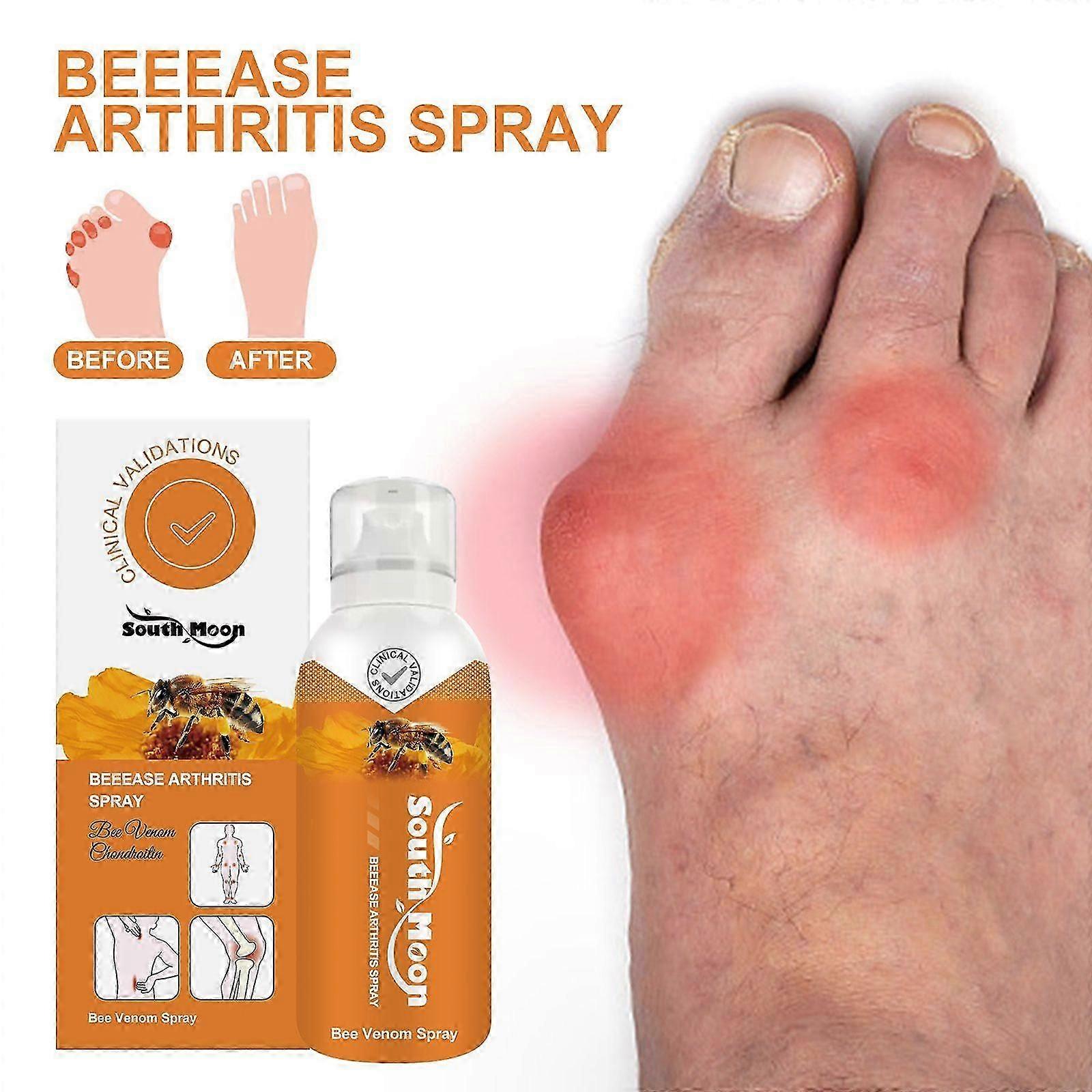 Beease Arthritis Spray