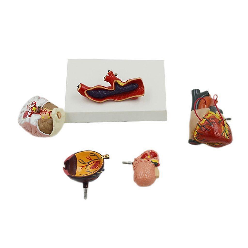 Human Hypertension Pathology Demonstration Model