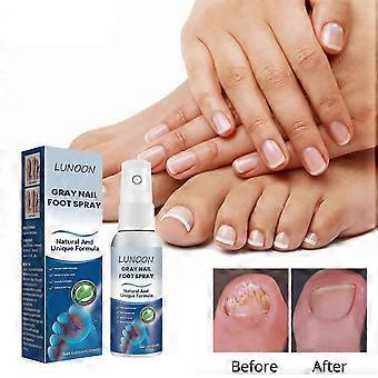 2025 Spray de tratamentos de unhas antifúngicos em qualidade médica, 30 ml, tratamentos de unhas antifúngicos, spray antifúngico 30ml 20231120