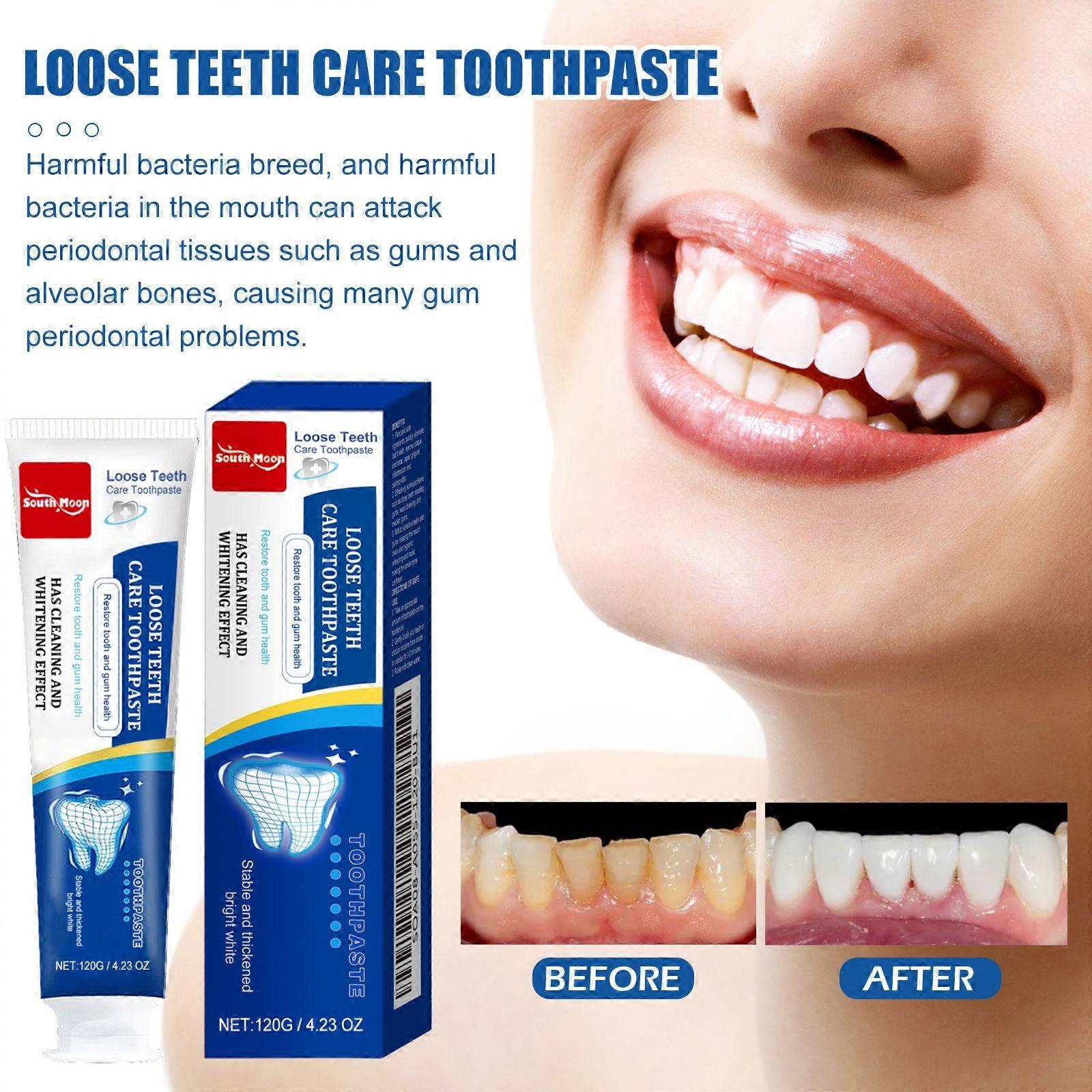 Toothpaste Contains Sodium Lauryl Sulfate And Hydroxypropyl Methylcellulose