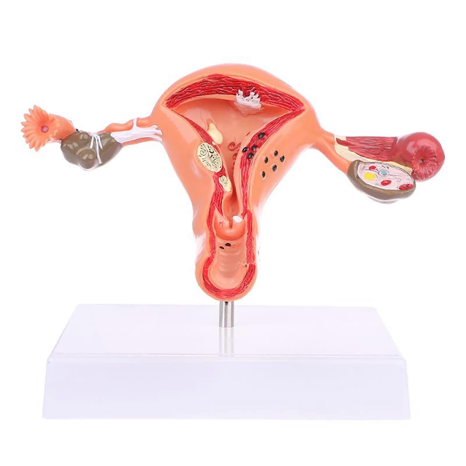 Human Uterus Model Simulation Female Reproductive Form Pathological Anatomical Model Uterine Ovarian School Teaching