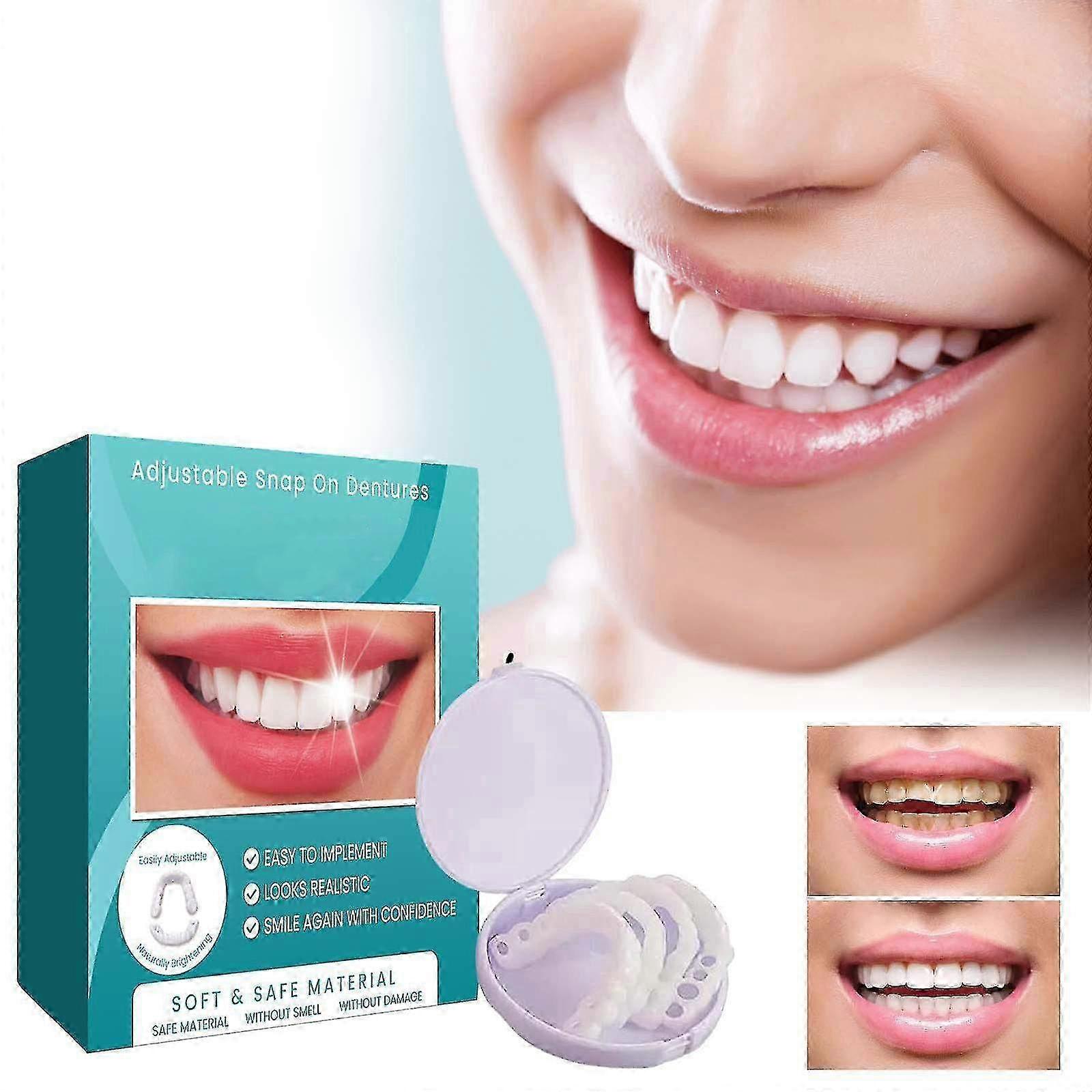 Adjustable Snap-on Dentures, Veneers Denture Braces Plus Denture Cases, Temporary Fillings Braces Interdental Fillings Straightening Denture