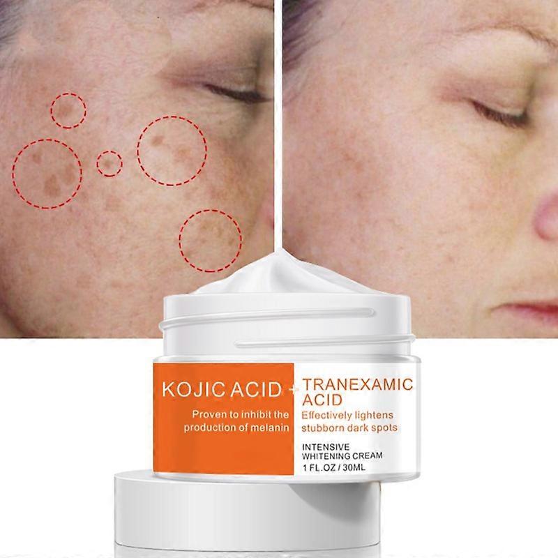 インテンシブホワイトニングクリーム コウジック酸トラネキサム酸クリーム メラニンの生成を抑制し、頑固なダークスポットクリームを明るくします