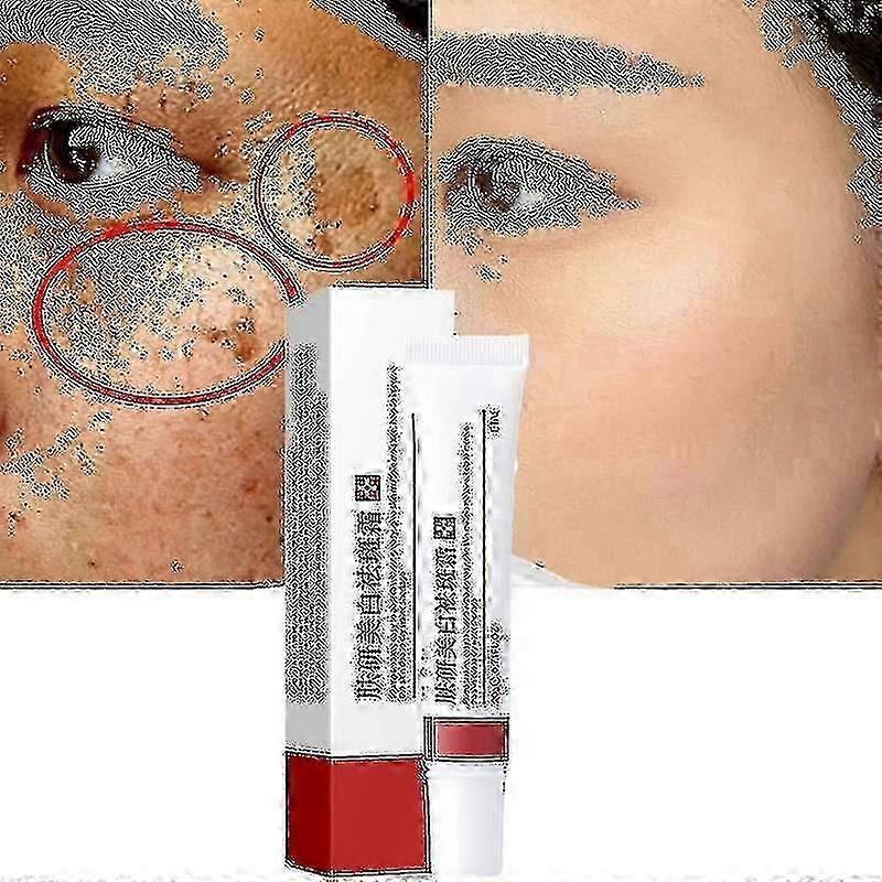 Cream To Remove Melasma And Melanin - 2023 Skin Care By Changzhao - In S And L Sizes Tw