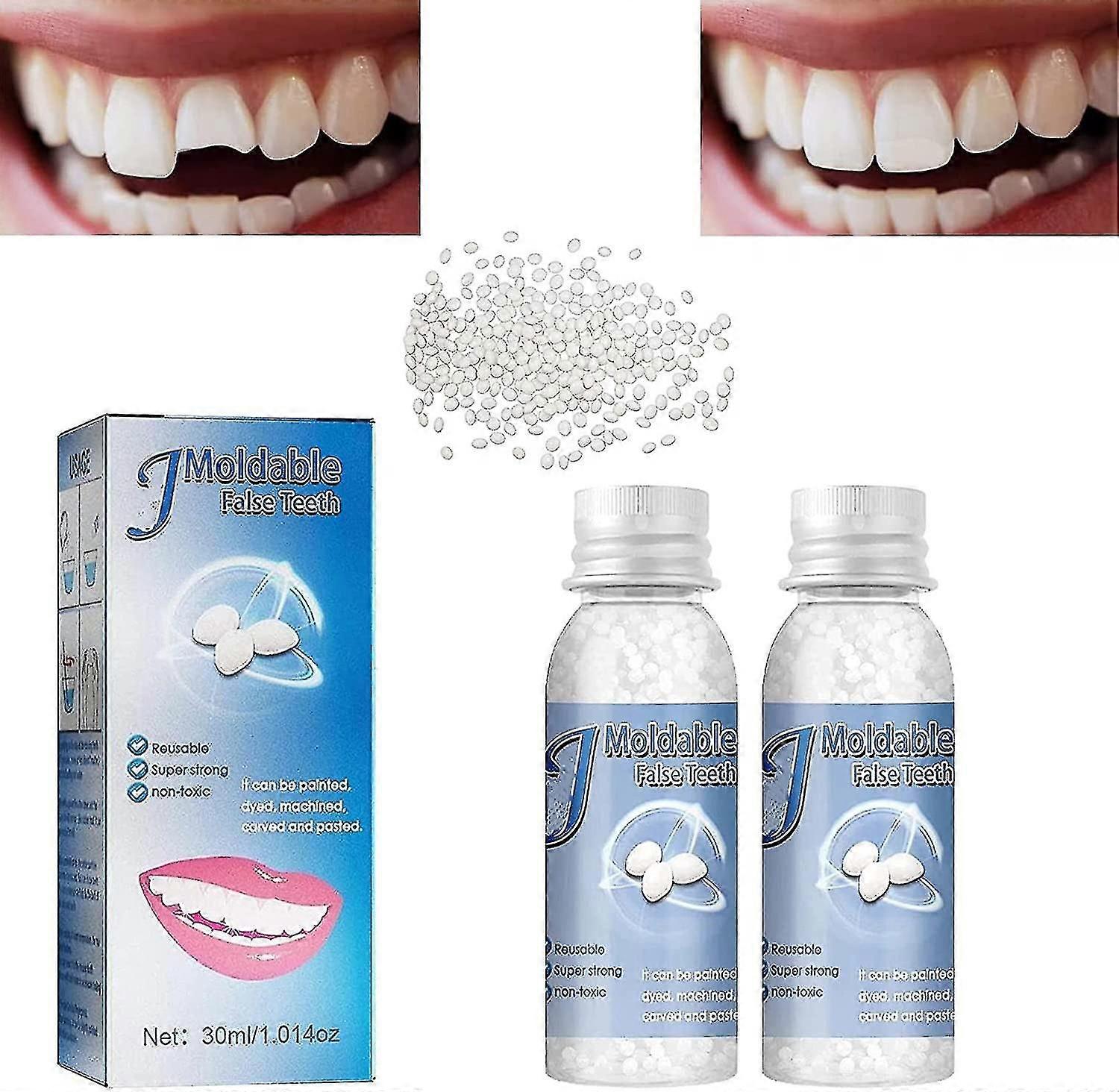 Moldable False Teeth Tooth Repair Granules, Teeth Repair Kit, Diy Temporary Tooth Repair Beads, For Temporary Fixing The Missing And Broken Tooth Repl