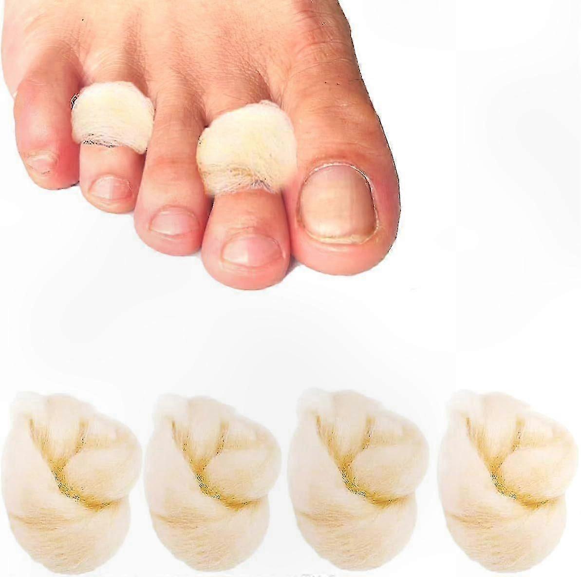 4 Packs Soft Lambswool Toe Cushions for Comfortable Toe Support, Foot Care Padding Solution
