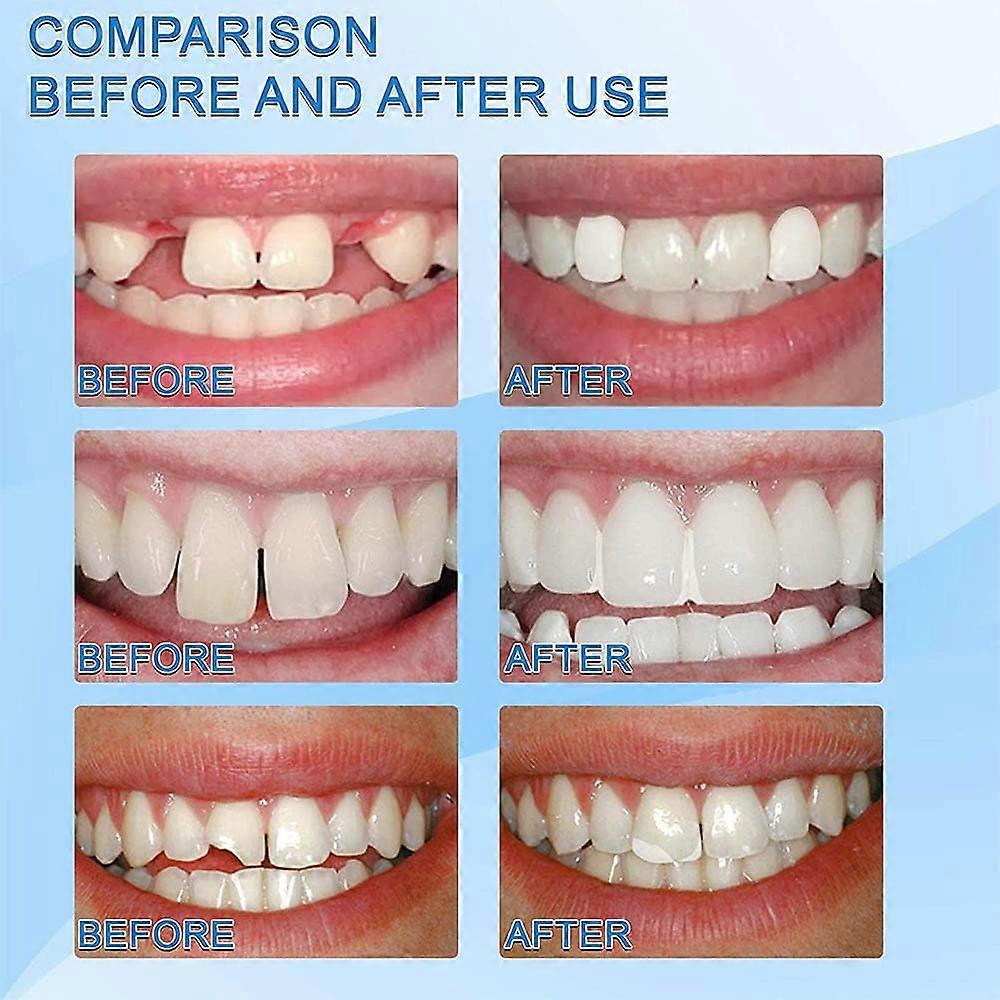 Dental Repair Denture Repair Beads for Temporary Fixing Filling Missing Broken Tooth Moldable Fake Teeth Temporary Tooth Repair Kits