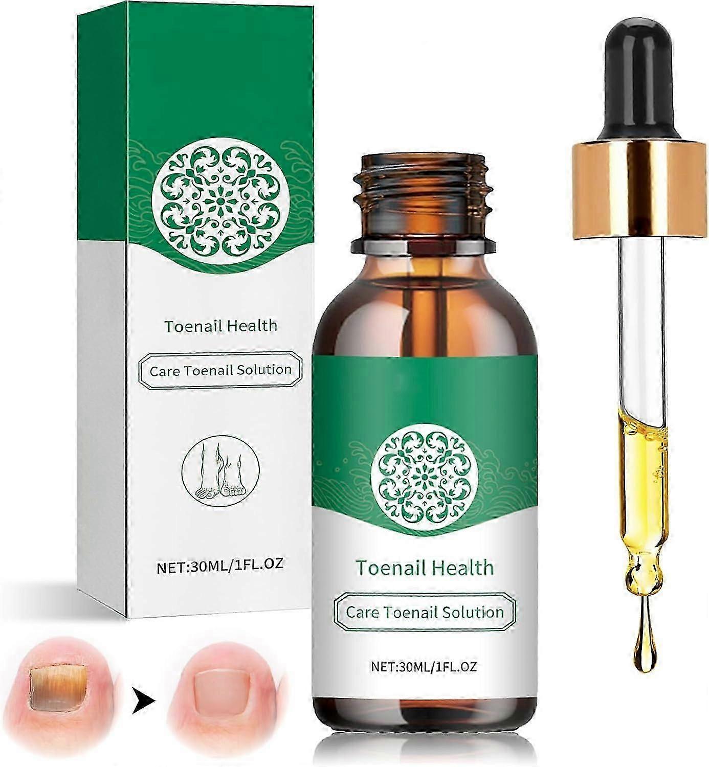 Solution de soin des ongles de 30 ml, Solution de réparation des ongles, Traitement des champignons des ongles, Solution de soin des ongles incarnés pour ongles mous