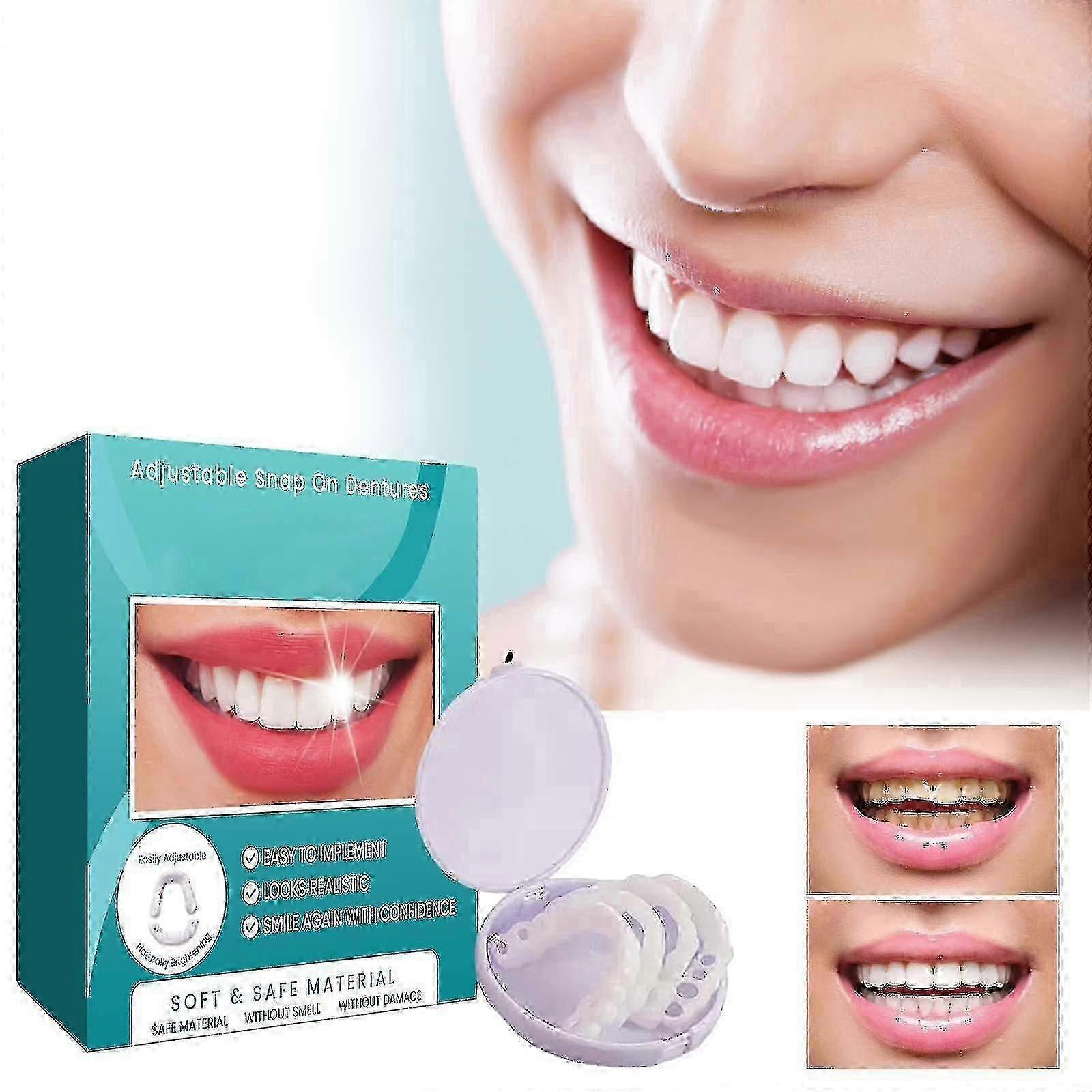 Adjustable Snap-on Denture Braces with Interdental Fillings & Cases