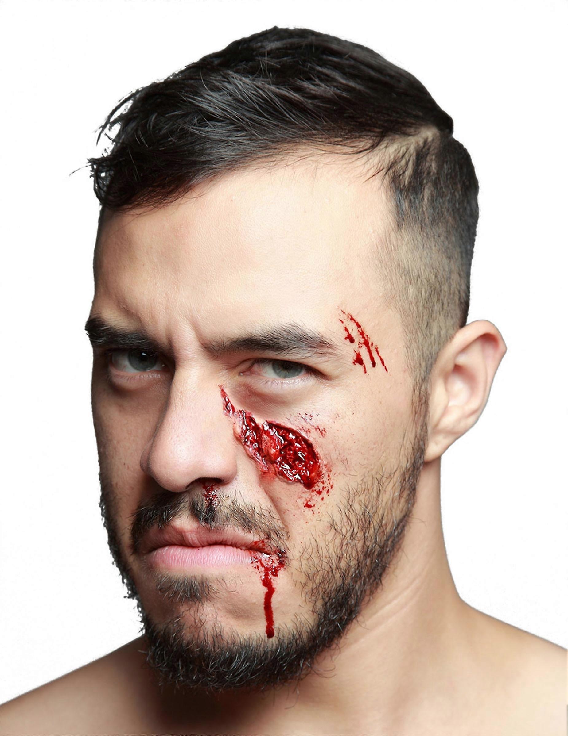 Fake sunken cheekbone injury