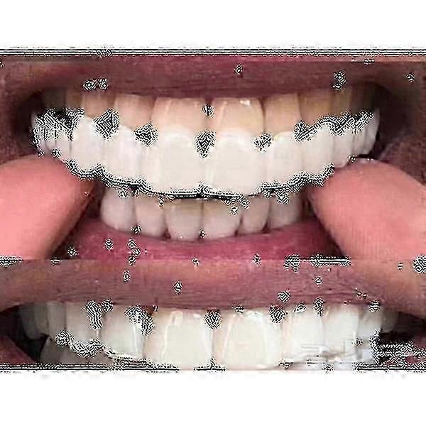 Upper/lower Comfort Fit Flex Whitening Denture Braces A