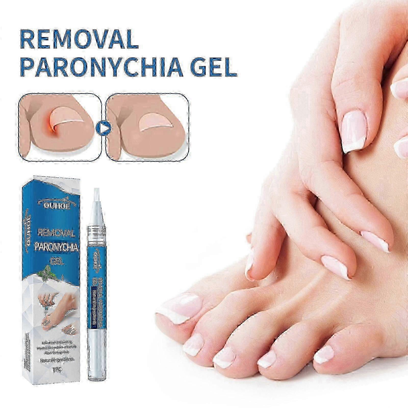 グレーネイルリペアジェル、リペアネイルグルーブ、厚みのあるネイルケアグレーネイルポリッシュペン