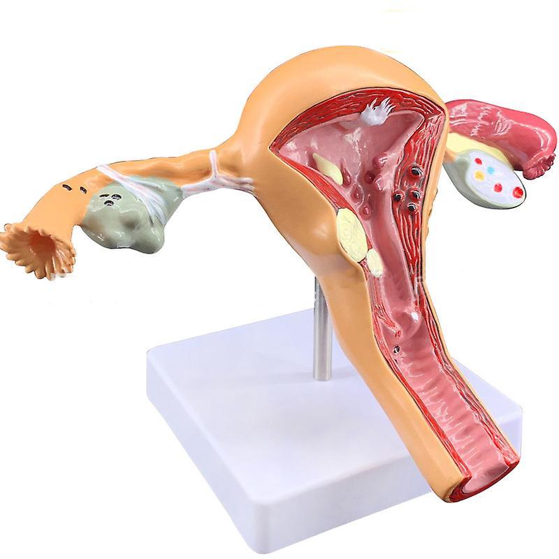 Simulated uterus model Medical teaching Demonstration Human body display model