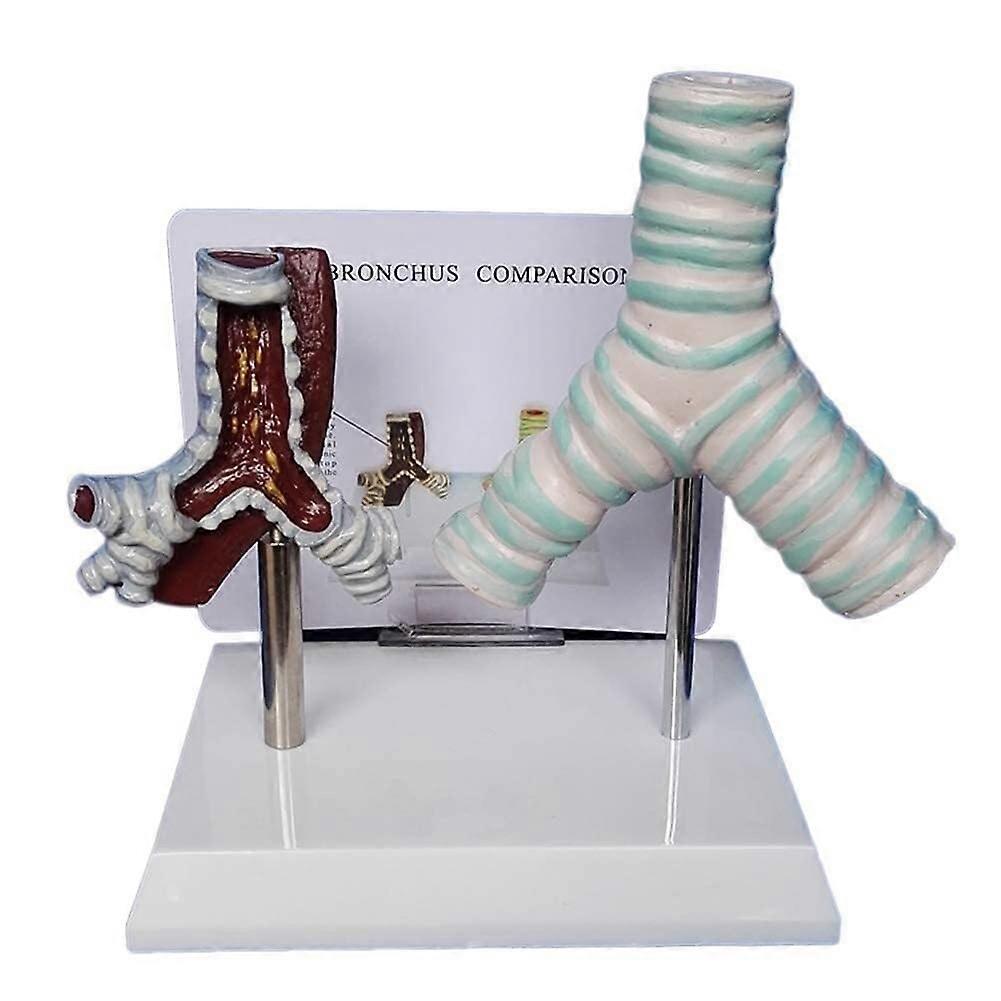 Anatomical Trachea Model with Dual Condition Comparison, Color‑Coded Human Respiratory System Teaching Tool