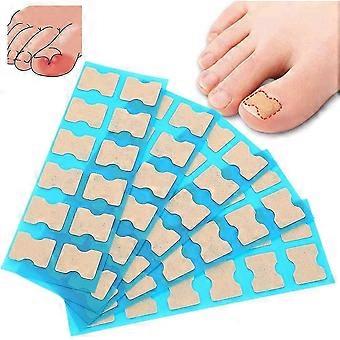 Ingegroeide teennagel stick patch, lijmvrije teen nagelcorrectie file patch paronychia