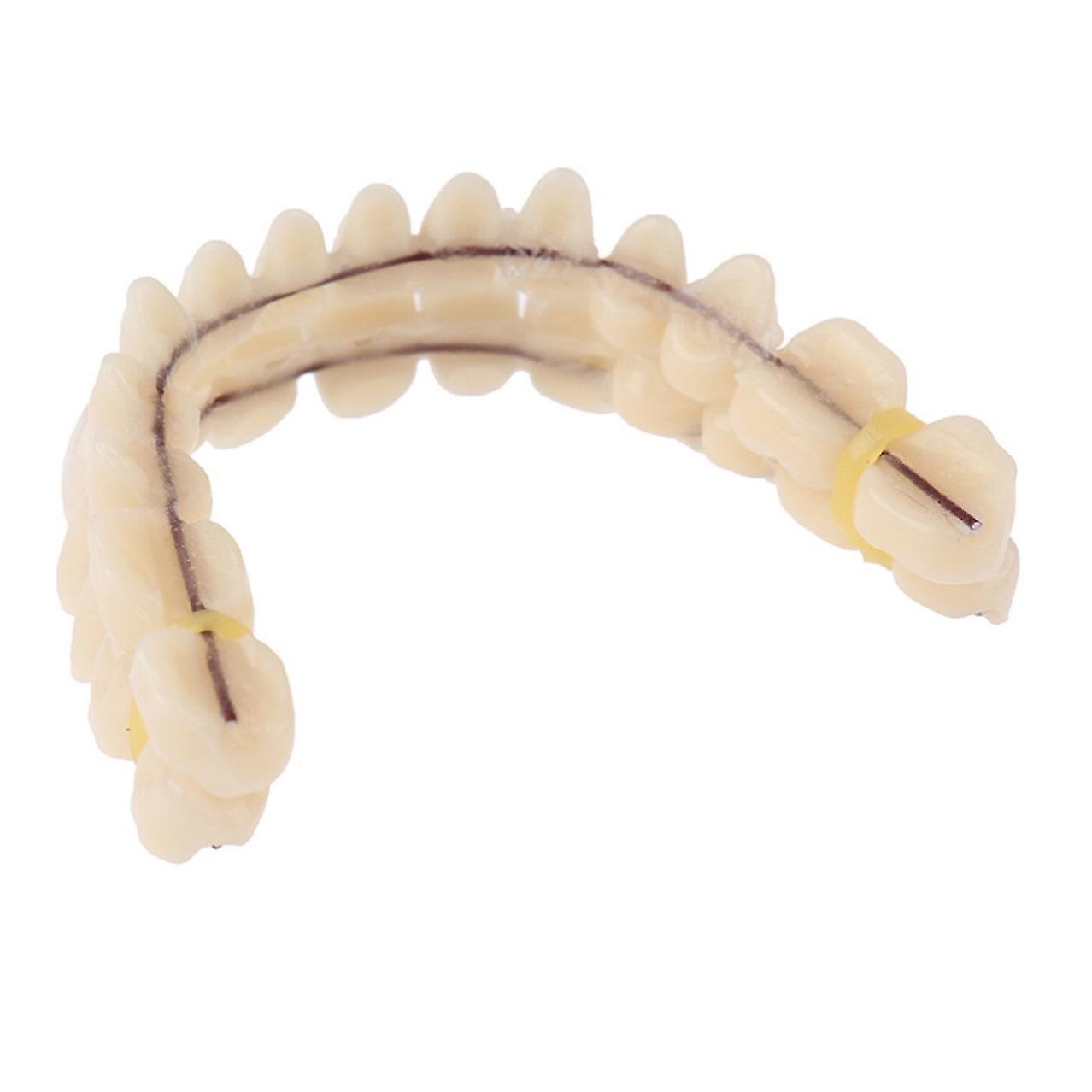 Implant Resin Dentures