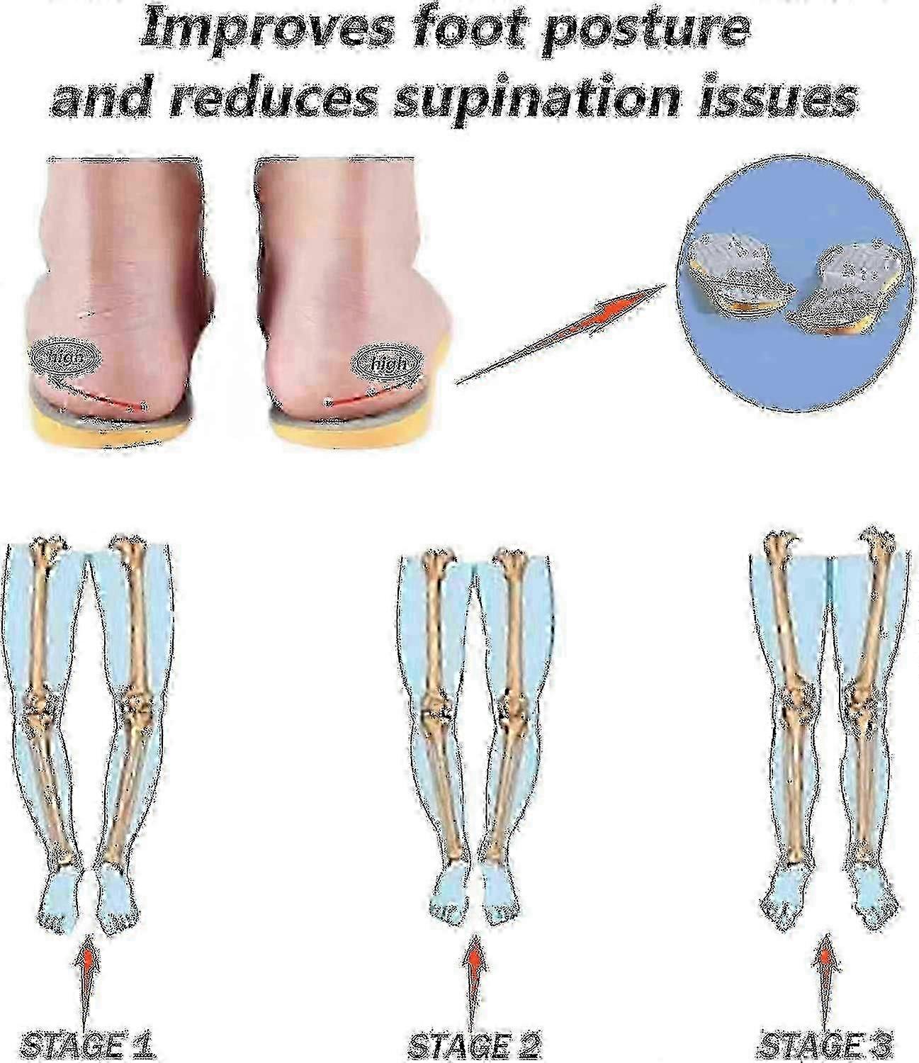 high arch support insoles compatible with foot alignment size 41-42
