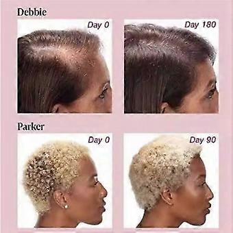 Hair Growth Supplements for Women, Thicker Fuller Hair Support for Thinning Hair and Hair Loss
