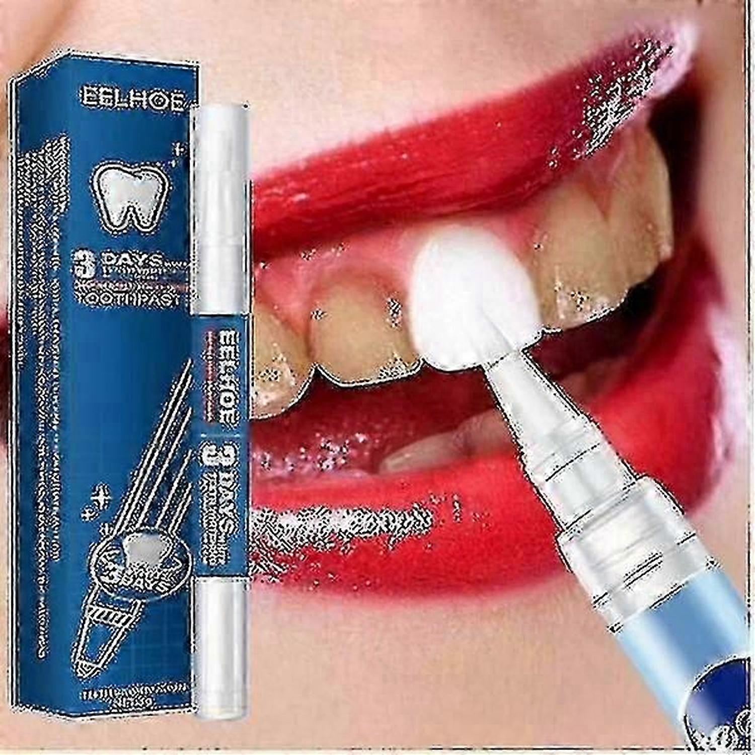 Λεύκανση Δοντιών Gel Pen Λευκό Λευκαντικό Οδοντικό Λευκαντικό Λευκά Δόντια - Youa