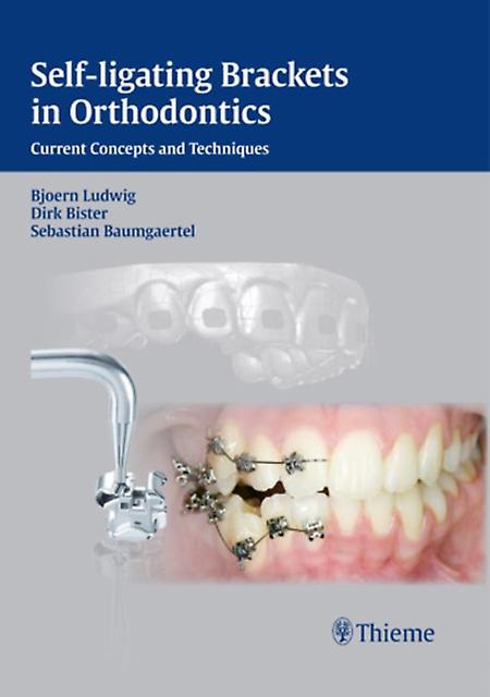 Selfligating Brackets In Orthodontics by Sebastian Baumgaertel Paperback Book