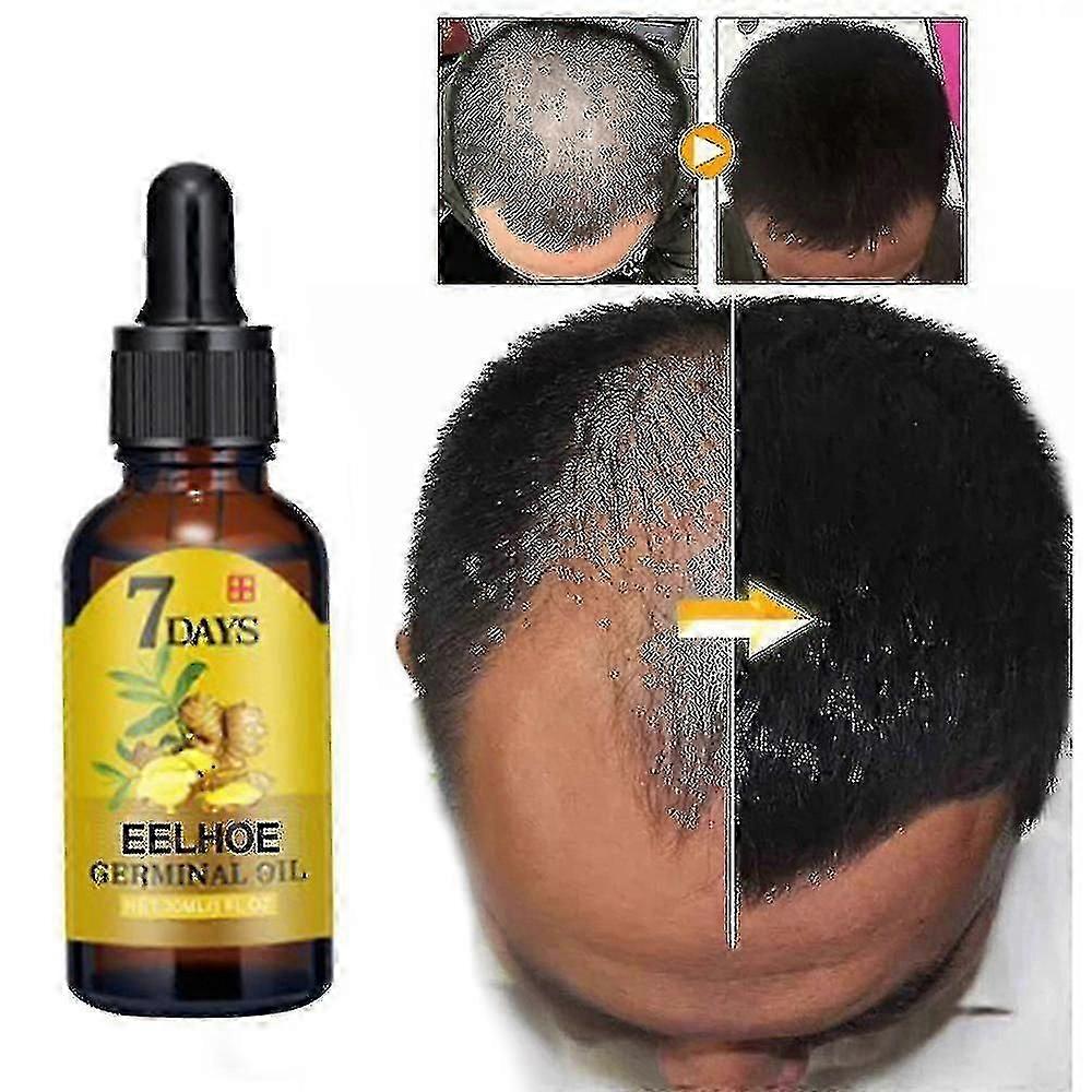 Eelhoe Ginger Hair Growth Fluid7