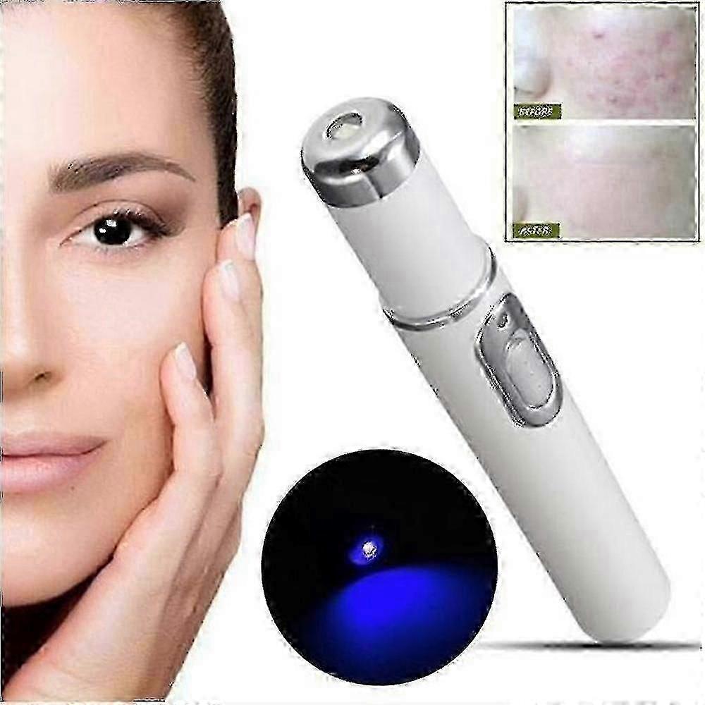 Blue Light Therapy Laser Pen for Spider Vein Removal Wrinkle and Acne Treatment