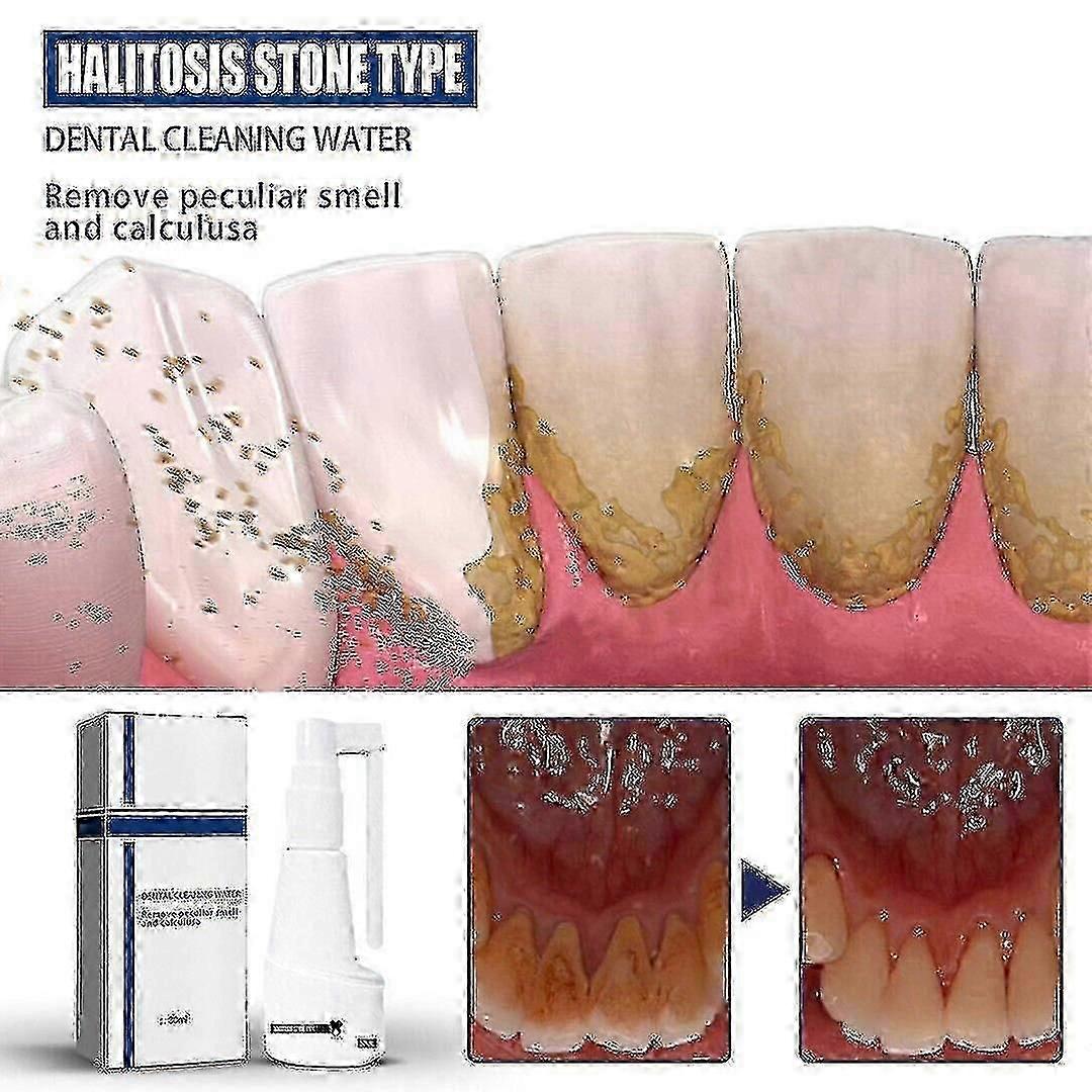 Tartar- Dissolving Tartar Removal Teeth Ful Removal Tootaste