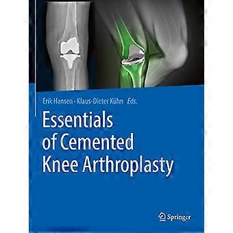 Essentials of Cemented Knee Arthroplasty
