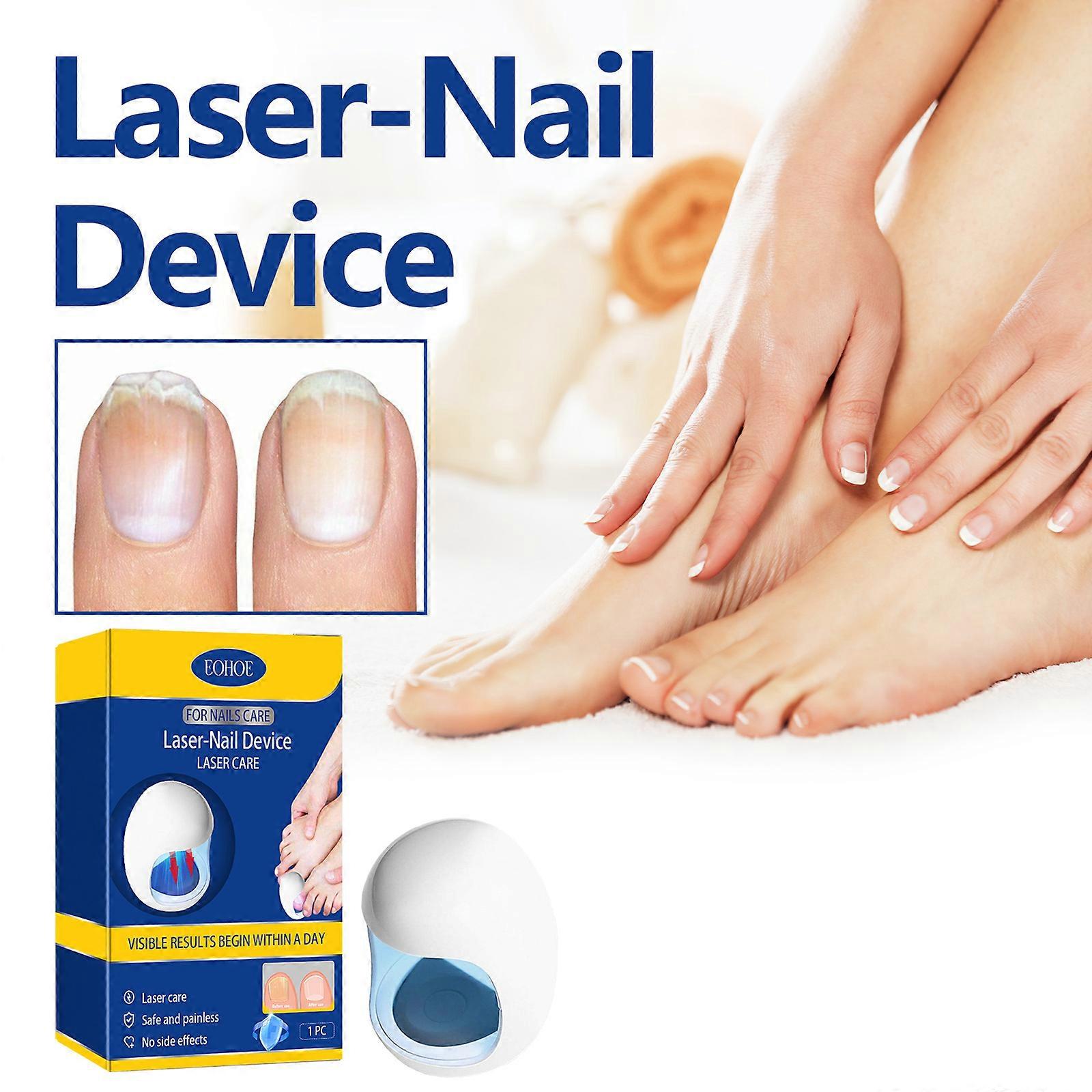 Nail Fungus Cleaning Laser Device,Nail Fungus Laser Treatment for Damaged Discolored Thick Toenails & Fingernails, Effective Rechargeable Nail Fungus