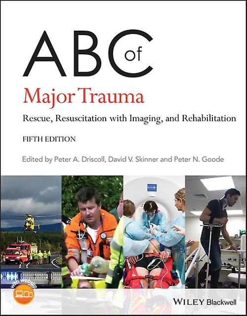 Abc Of Major Trauma Paperback