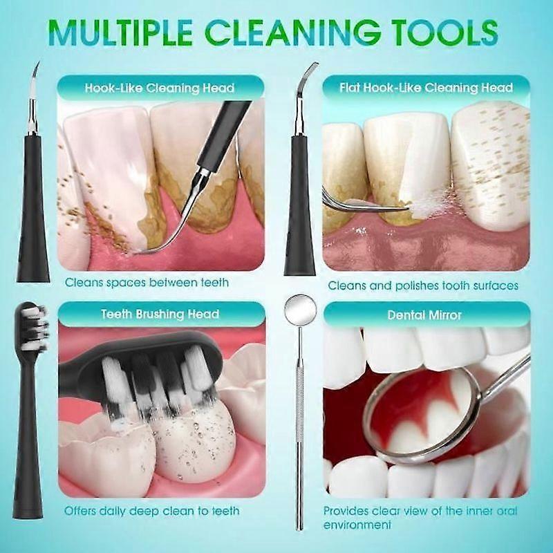 thumbnail image 2 of 4-Piece Dental Care Kit – Stainless Steel Tooth Scraper & Plaque Remover For Home Use 2 of 6