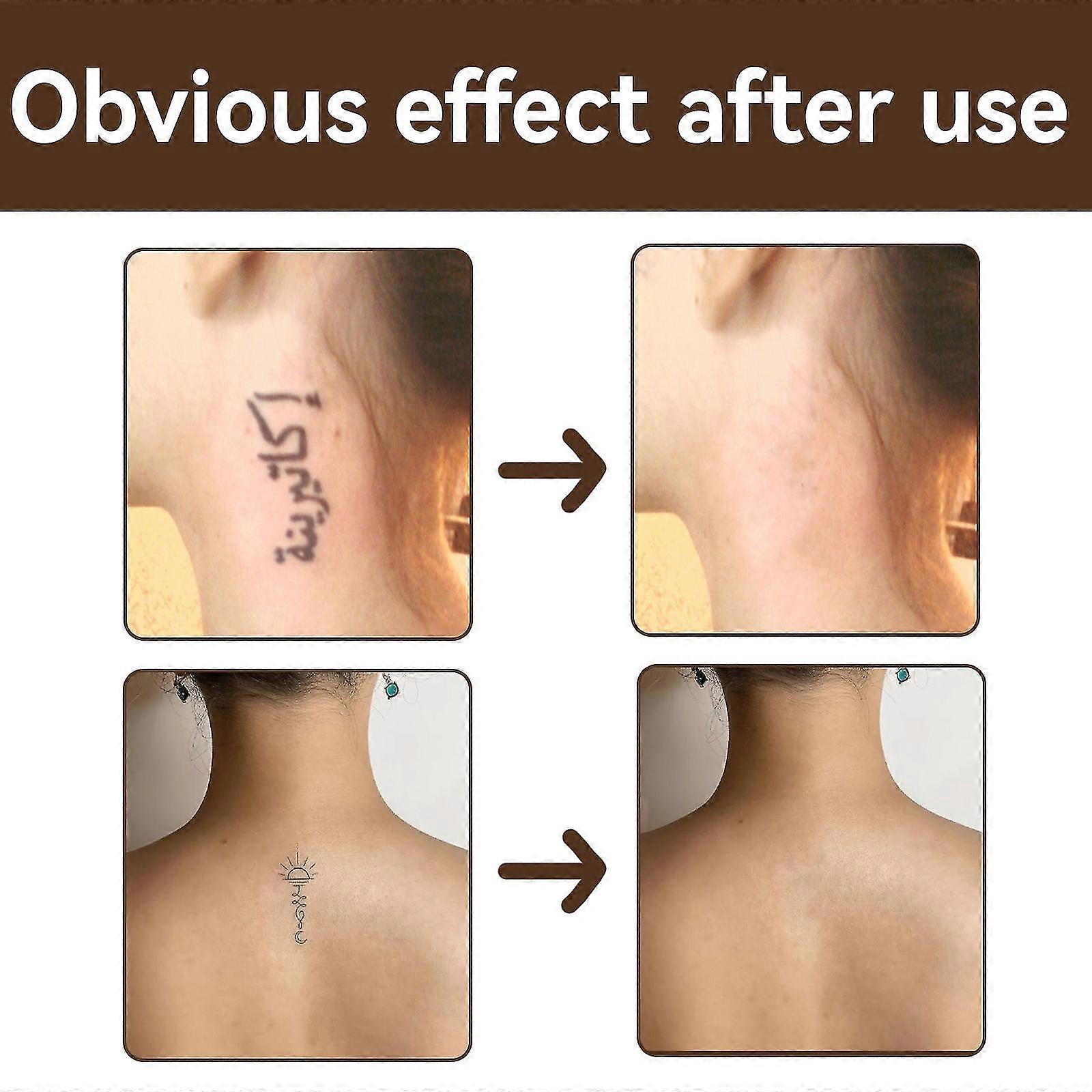 Vedenpitävä tatuointipeitevoide - kirkastava ja näkymätön suoja arville, syntymämerkeille ja näppylöille