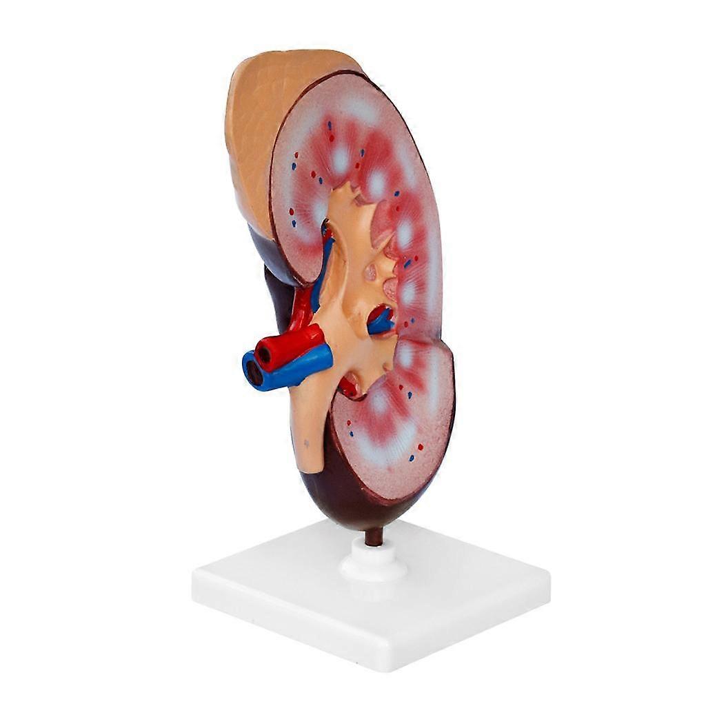 Human Body Kidney Anatomical Model, Educational Tool Teaching Aids, School Learning Tool, Kidney Structure Model