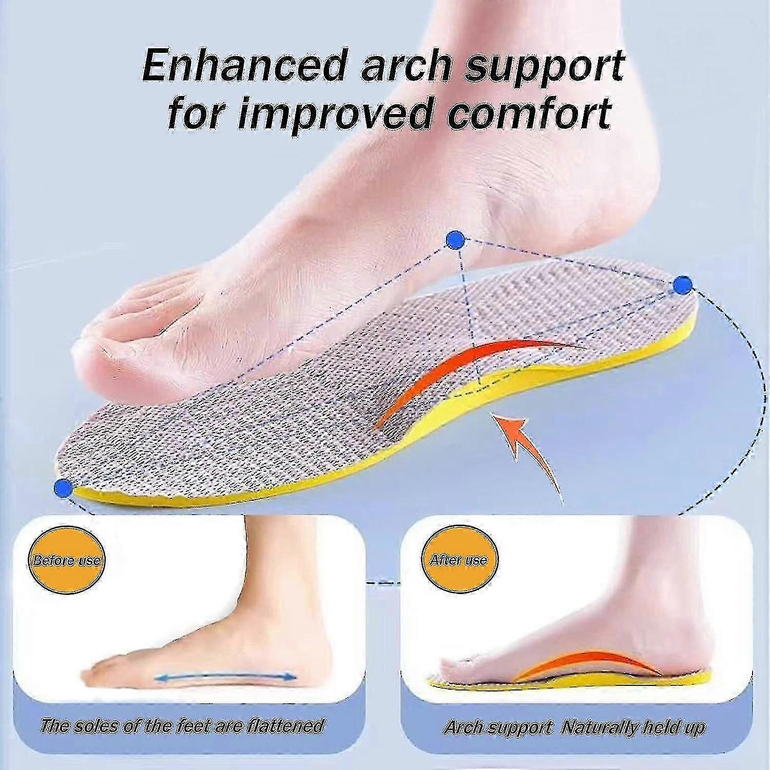 Supination Insoles For Over Supination & High Arch Support,orthotic Inserts For Foot Alignment, Knock Knee Pain, Bow Legs, O/x Type Leg