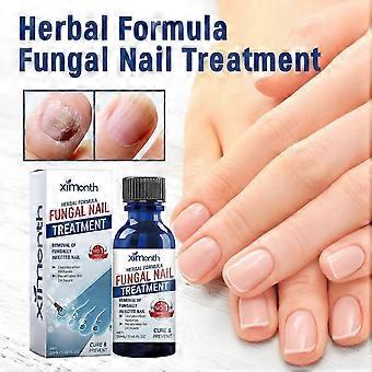 Kruidenformule Schimmelnagel Paronychia Behandeling Gel, Teennagel Schimmel Behandeling, Extra Sterkte Nagelreparatie Oplossing Voor Vingers En Teennagels
