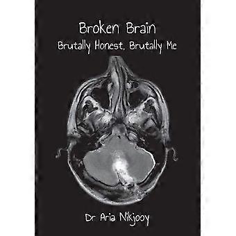 Broken Brain: Brutal ehrlich, brutal ich