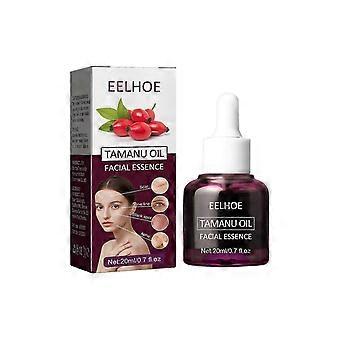 Tamanu Facial Oil, Repair Acne, Fade Wrinkles, Clear Skin, Natural Moisturizer ,20ml