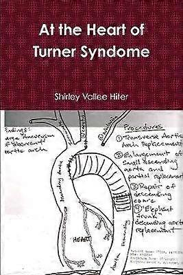 At The Heart of Turner Syndrome
