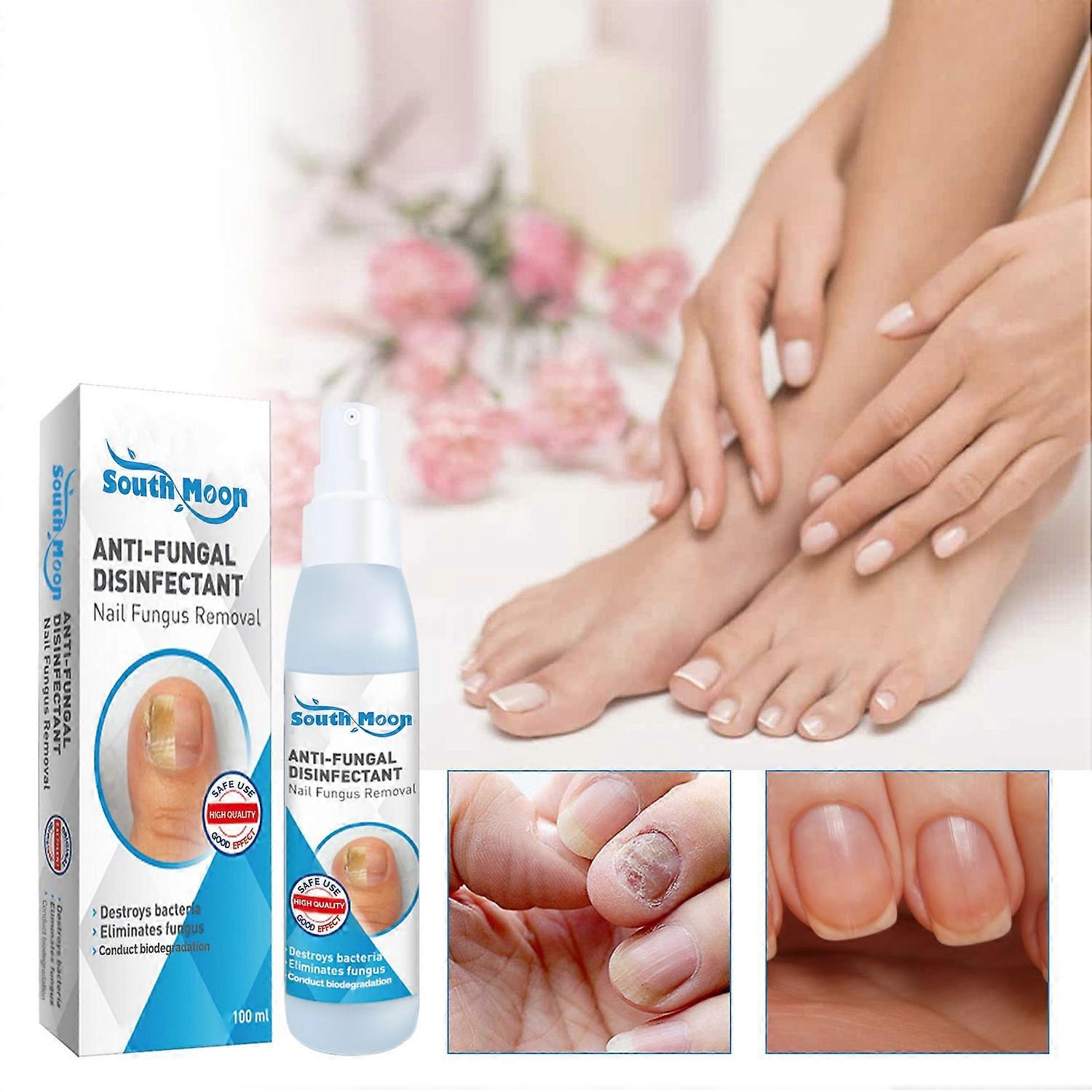 جنوب القمر المطهر المضاد للفطريات إزالة فطريات الأظافر ، أظافر رمادية لليد والقدم نظيفة إصلاح ناعمة