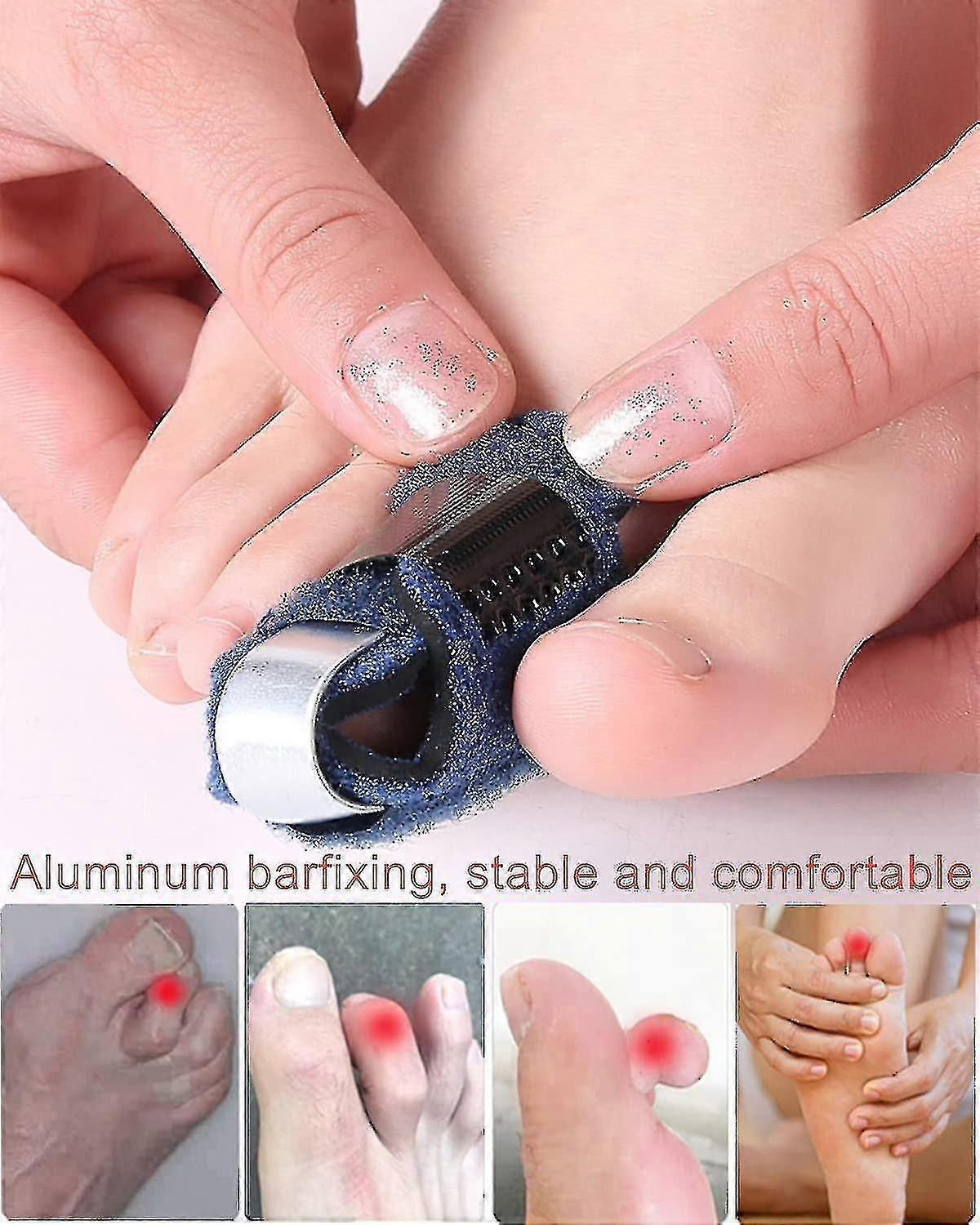 2pcs Toe Splint Broken Toe Brace, Toe Straightener For Hammer Toe, Curled Toe, Broken Toe Finger Joint Protective Band