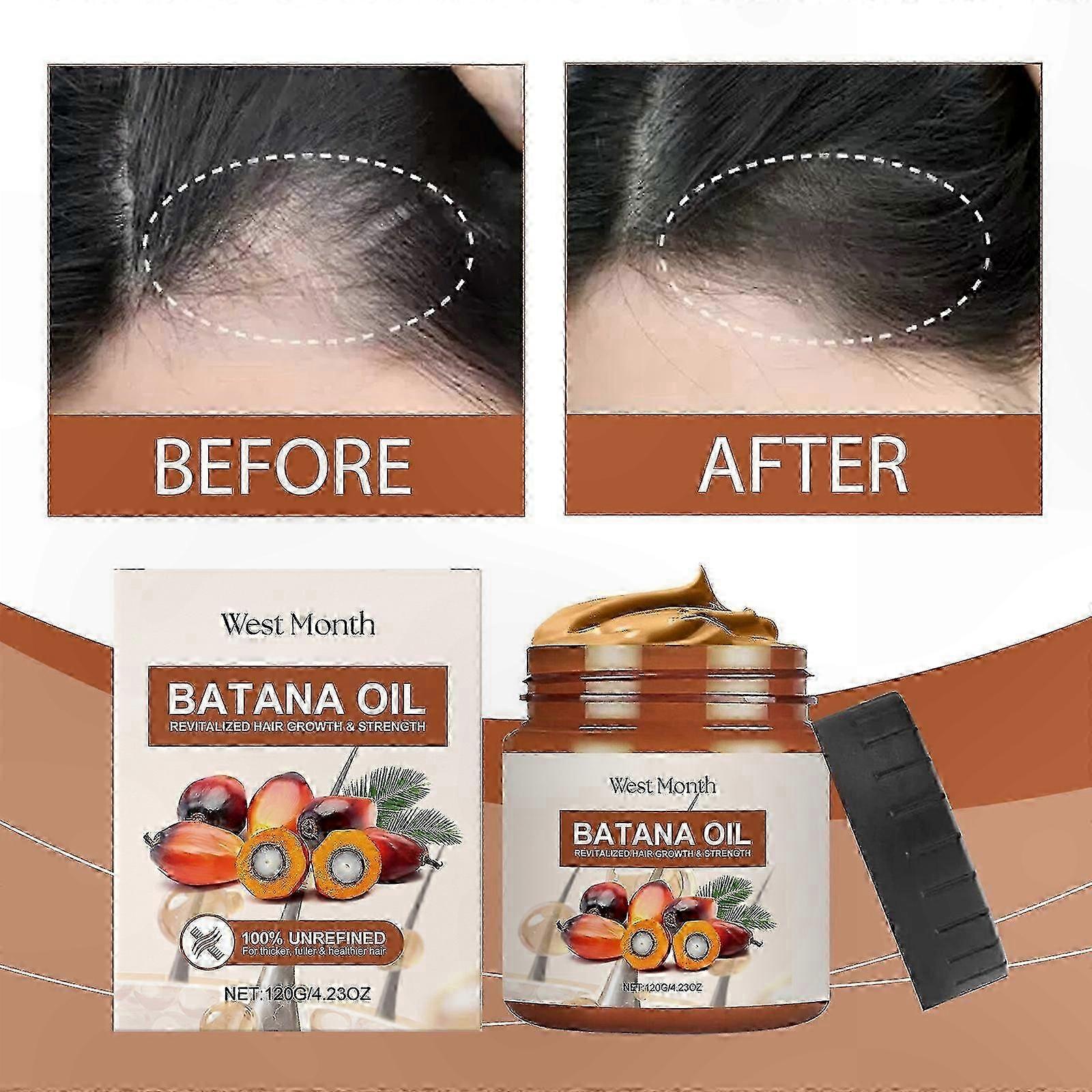 Natural Oil for Hair Growth, Scalp Hydration, Damage Repair and Loss Prevention Solution