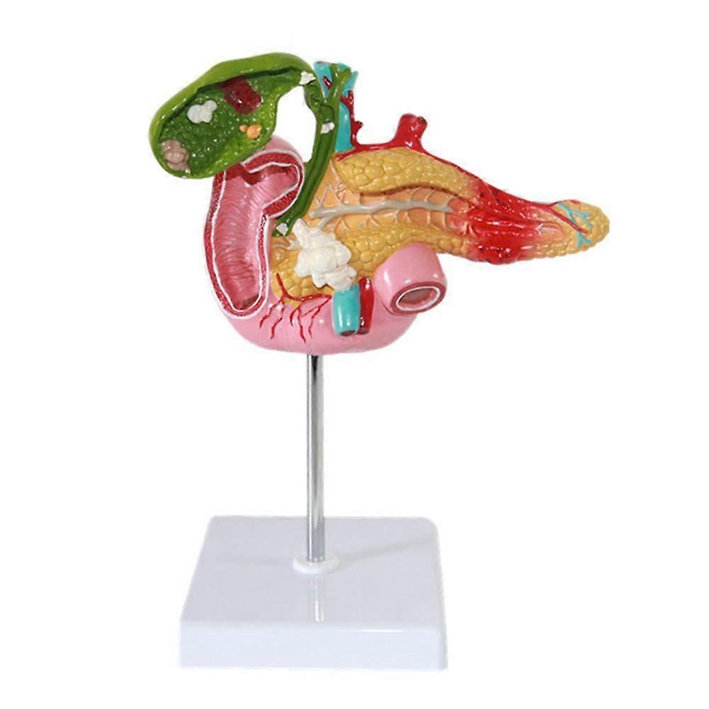 Pancreatic Duodenal Gallbladder Pathology Green Human Anatomy Model for Science Teaching Tools Medical Model with Base