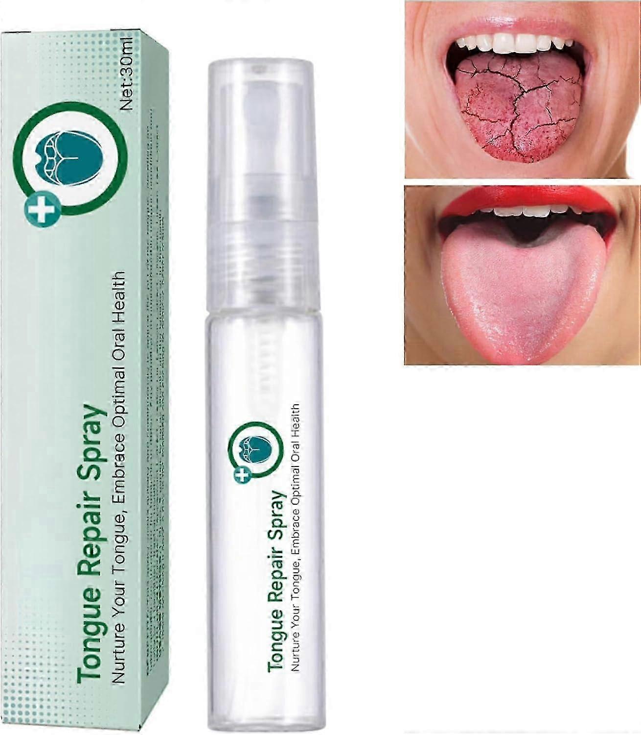 Tongue Repair Spray, Mouth Odor Eliminator for Dryness& Bad Breath,Fissured Tongue Relief Spray, Instant Dry Mouth Relief,Breath Freshener Spray