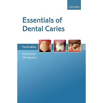 Essentials Of Dental Caries 4e P - KIDD