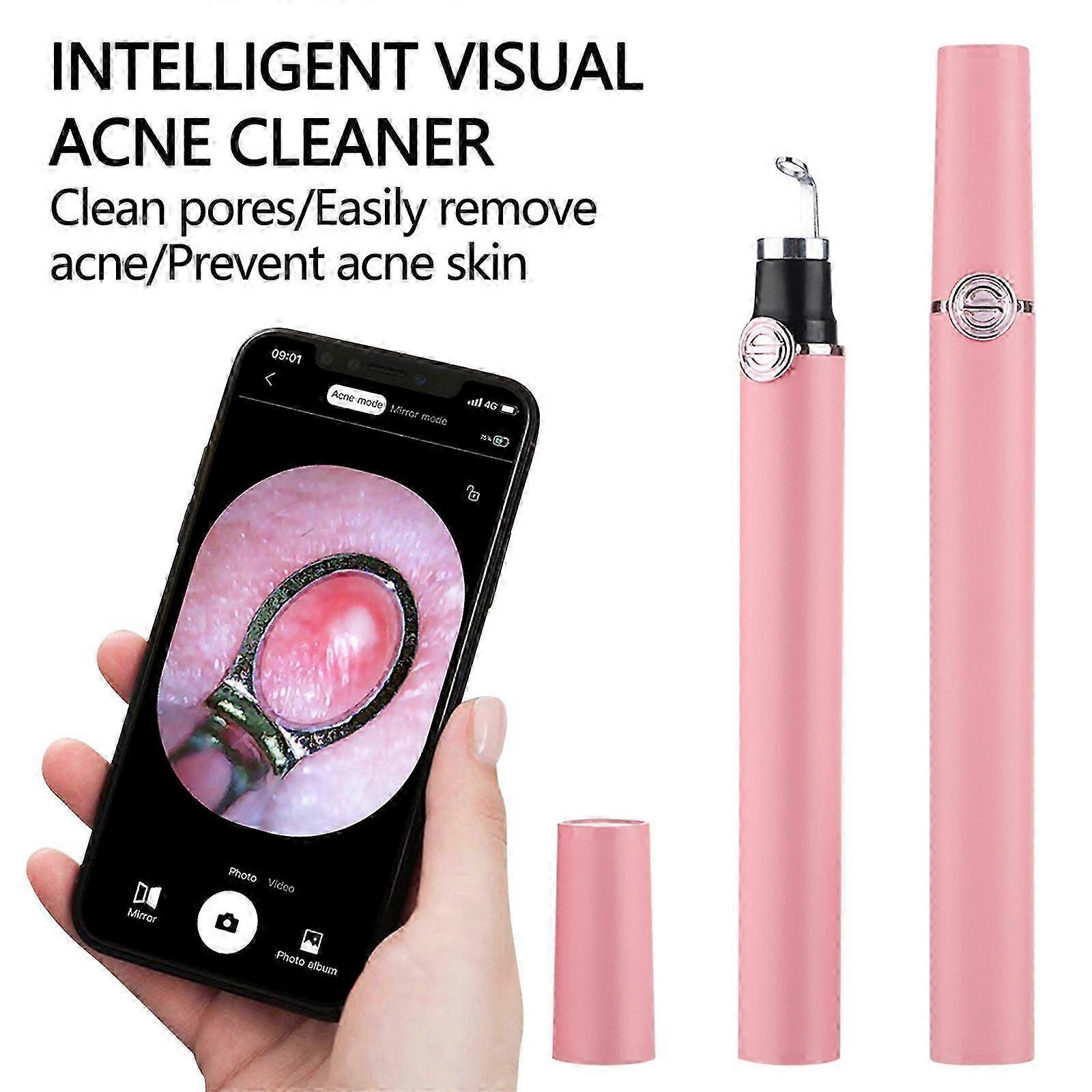 Visual Needle Intelligent Blackhead Squeezing WiFi HD Camera Squeezing Glowing