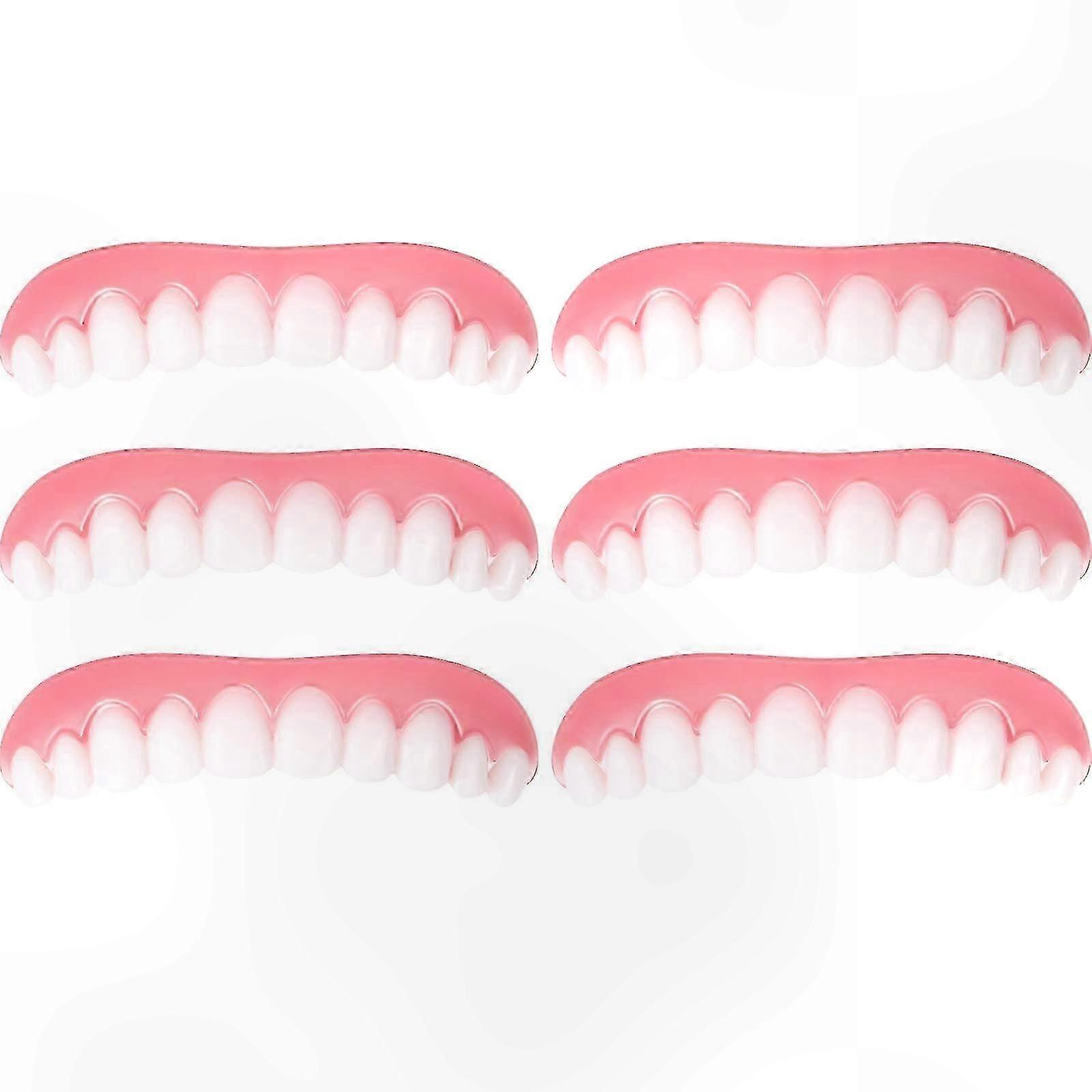 Custom Fit 6-Pack Temporary Veneers for Upper Teeth Whitening Solution